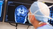 Alzheimer'a neden olan plakları eriten molekül