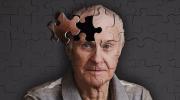 Alzheimera neden olan faktörler