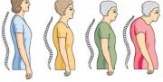 Osteoporozdan korunmak için...