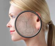 Kuru Cildin Bakımı